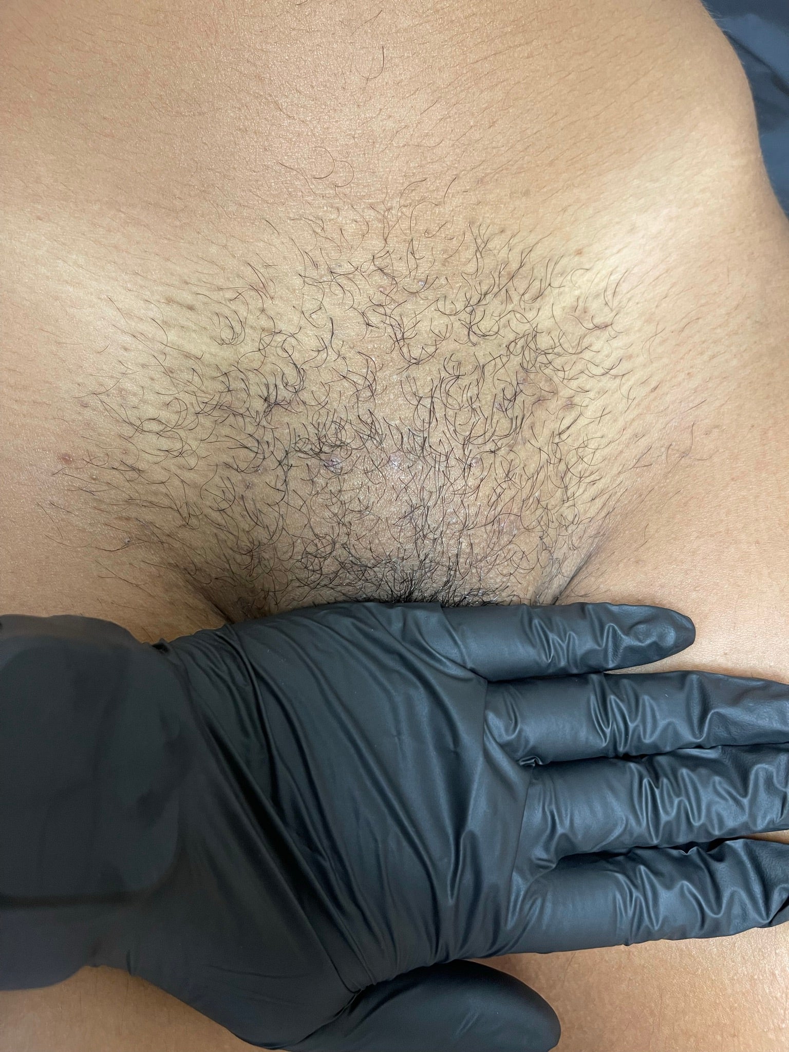 Brazilian Waxing The Bikini Club Rva