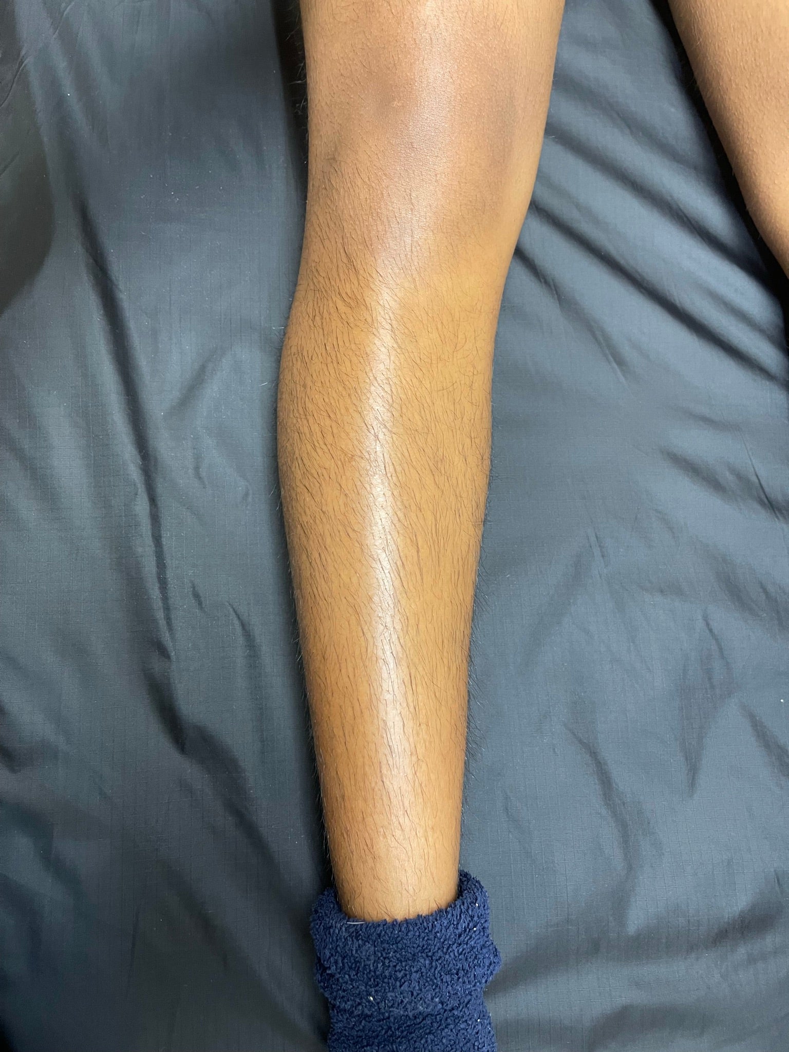 Brazilian Waxing The Bikini Club Rva