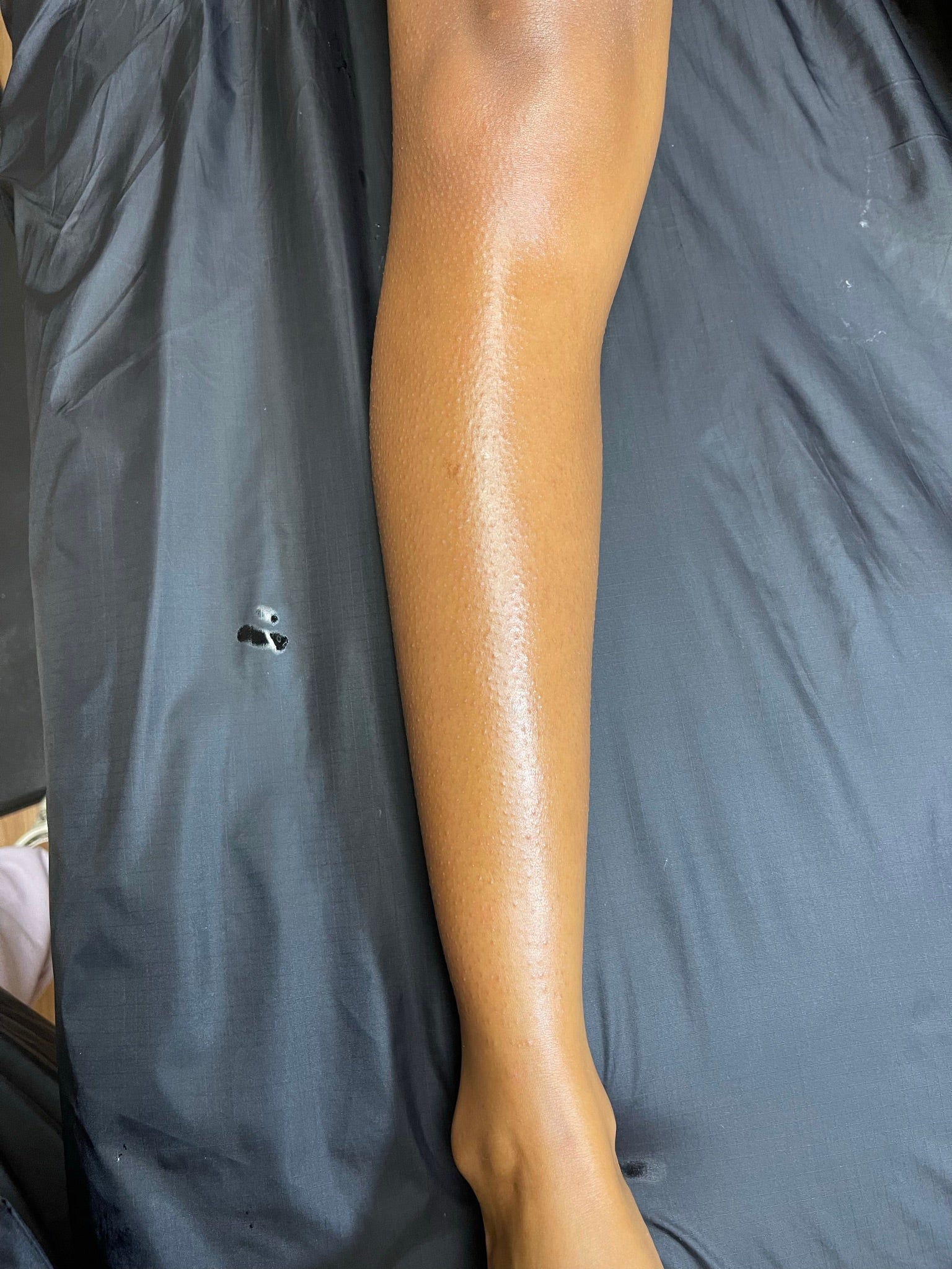 Brazilian Waxing The Bikini Club Rva